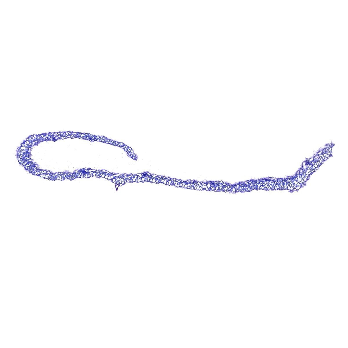 甲苯胺藍(lán)染色