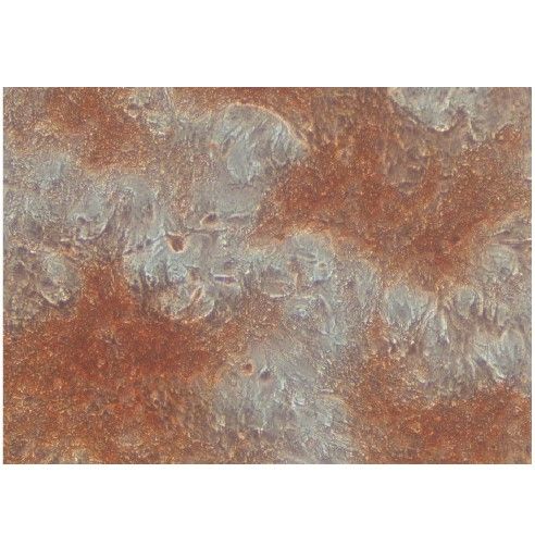 細胞成骨誘導茜素紅染色