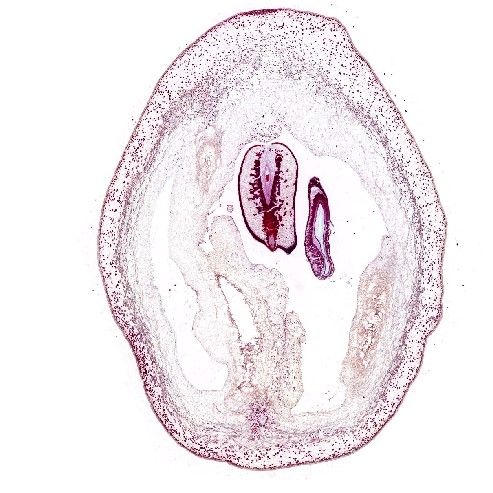 葡萄番紅固綠染色
