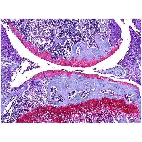 膝關(guān)節(jié)番紅固綠染色