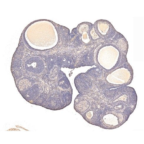 卵巢免疫組化