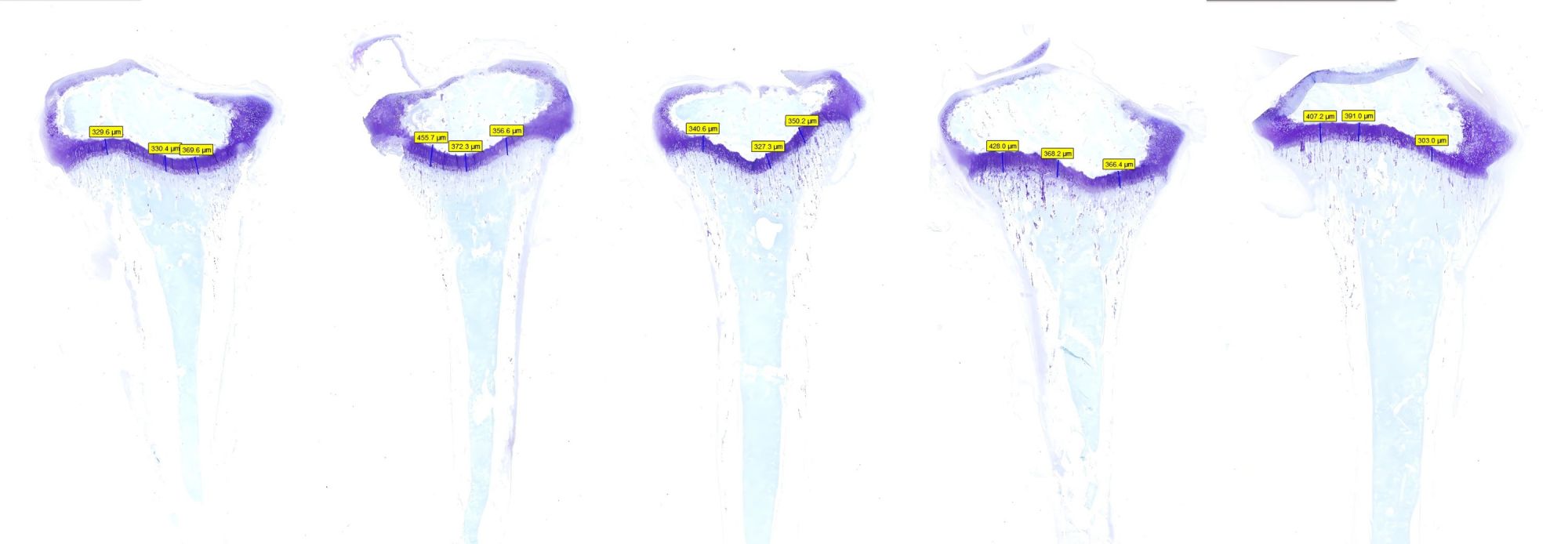 阿利新藍(lán)染色骨組織+測量