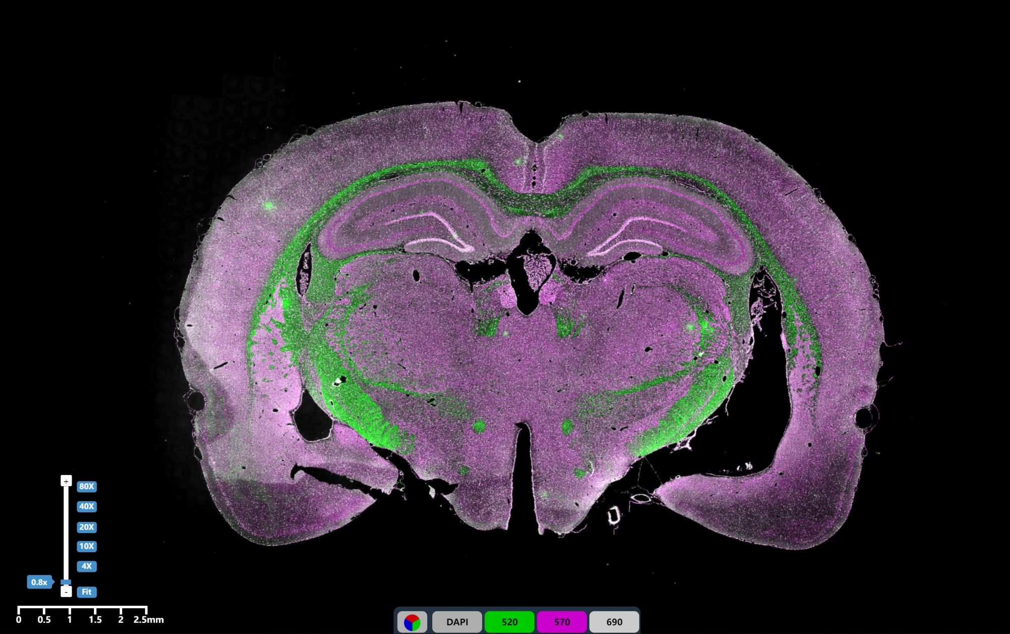 免疫熒光三標(biāo)腦組織