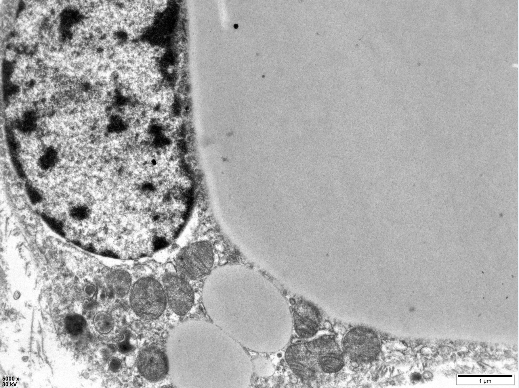 脂肪細(xì)胞電鏡