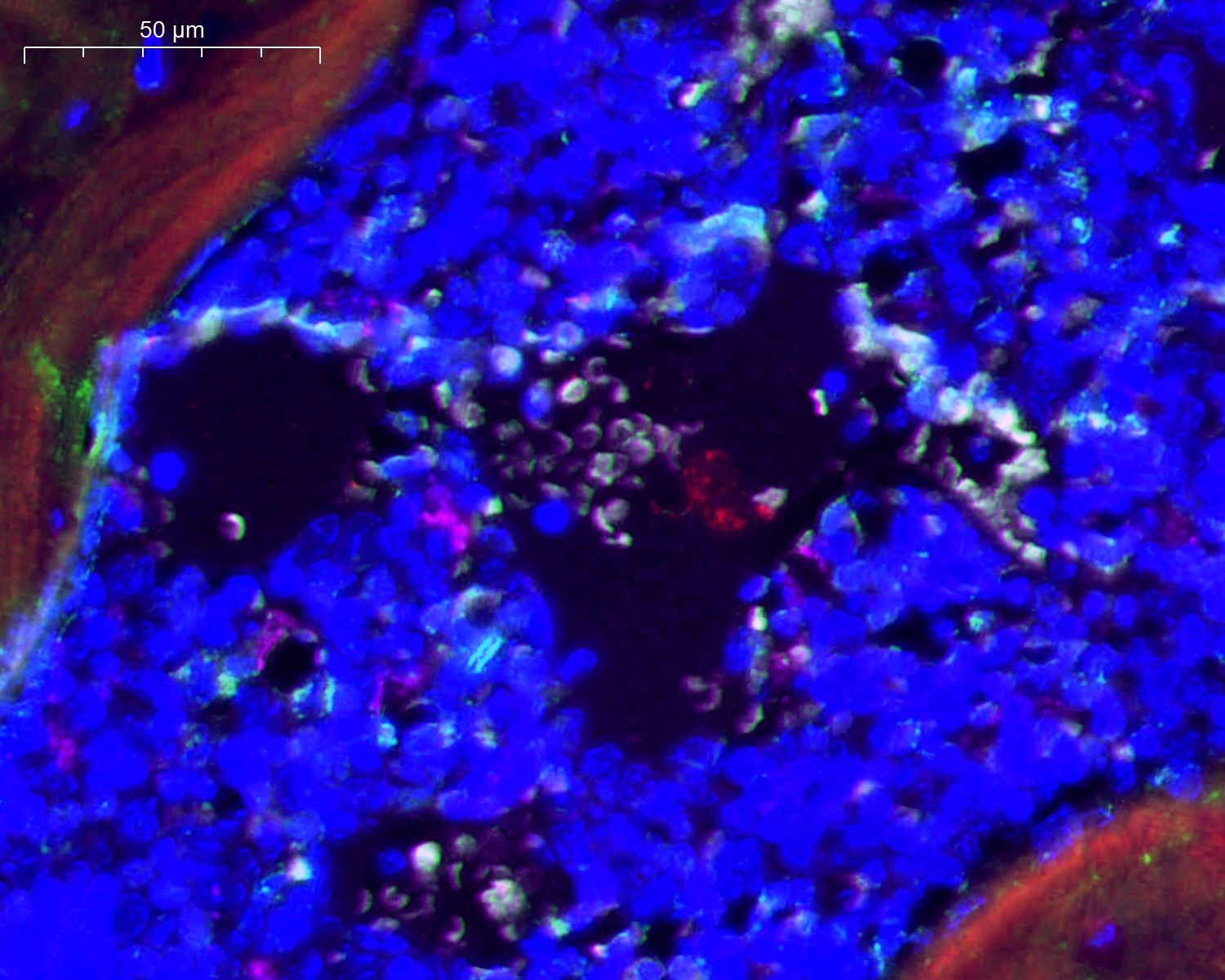 mIHC的檢測(cè)案例